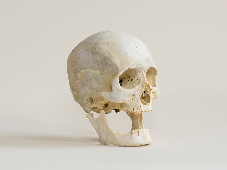 Photograph of human skull on a white surface